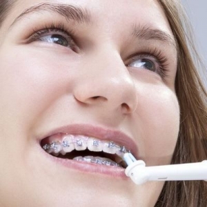 คนที่จัดฟันสามารถใช้แปรงสีฟันไฟฟ้าได้หรือไม่ และดีกว่าใช้แบบปกติหรือไม่